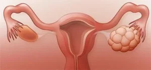 Ovary and Uterus Clean Reviews